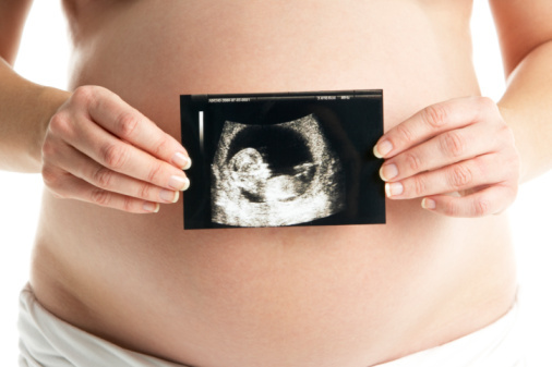 Prenatal fitness tips