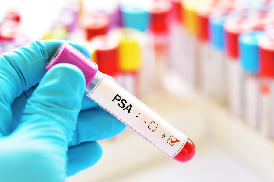 PSA test vial.