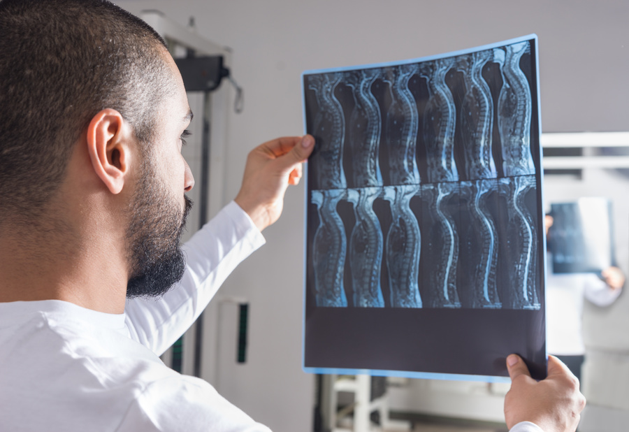 Medical doctor looking at x-rays.
