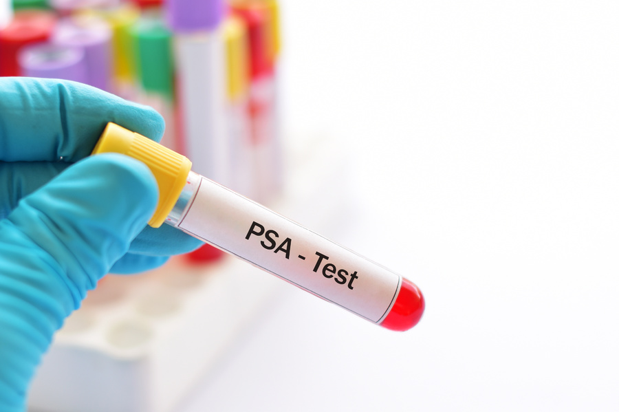 PSA test tube.