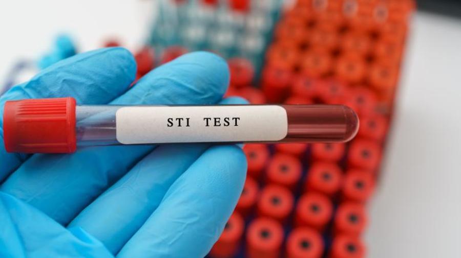 STI test vial.